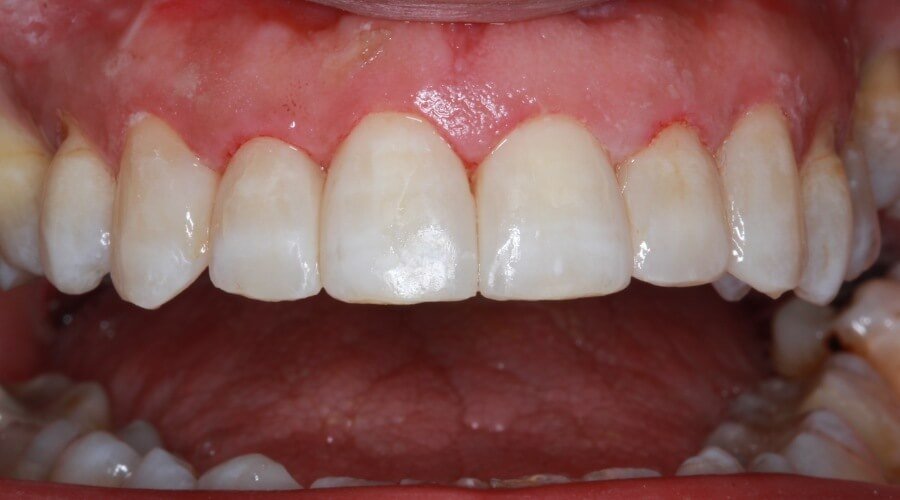 Real Smile Transformation Image