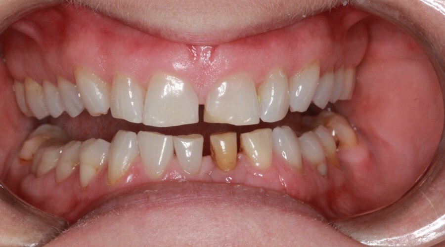 Real Smile Transformation Image