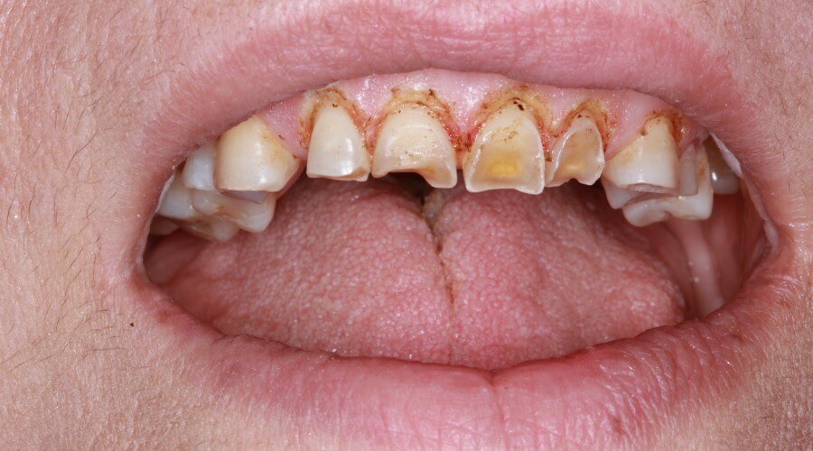 Real Smile Transformation Image