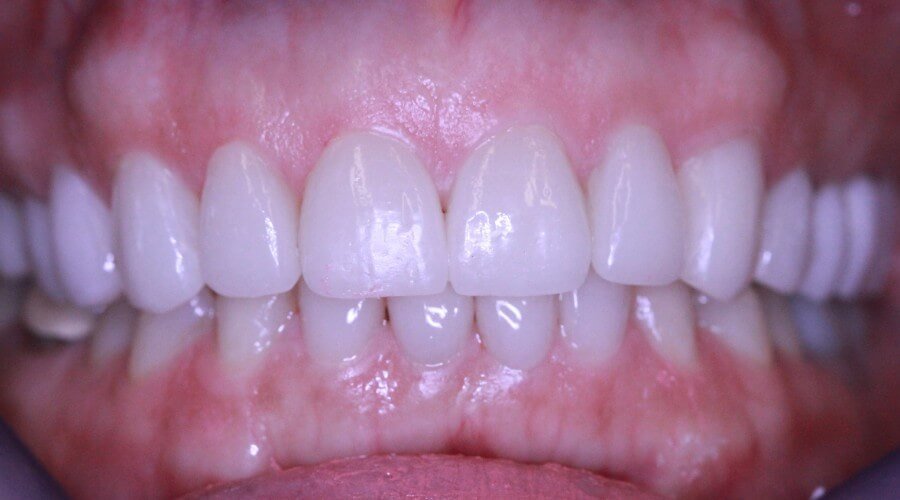 Real Smile Transformation Image