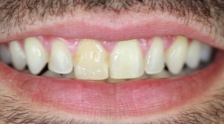 Real Smile Transformation Image