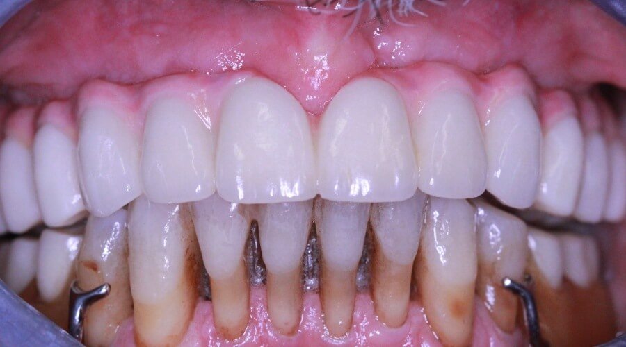 Real Smile Transformation Image