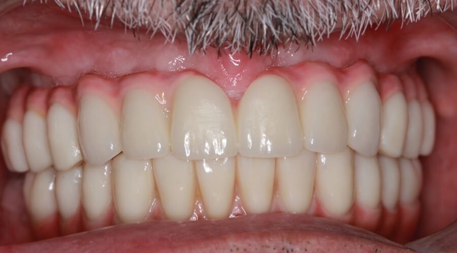 Real Smile Transformation Image