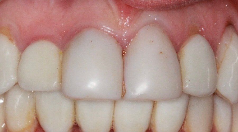 Real Smile Transformation Image