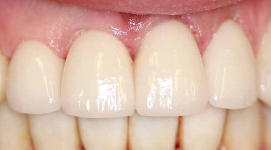 Real Smile Transformation Image