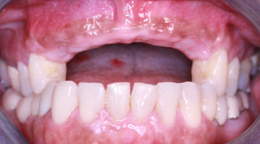 Real Smile Transformation Image