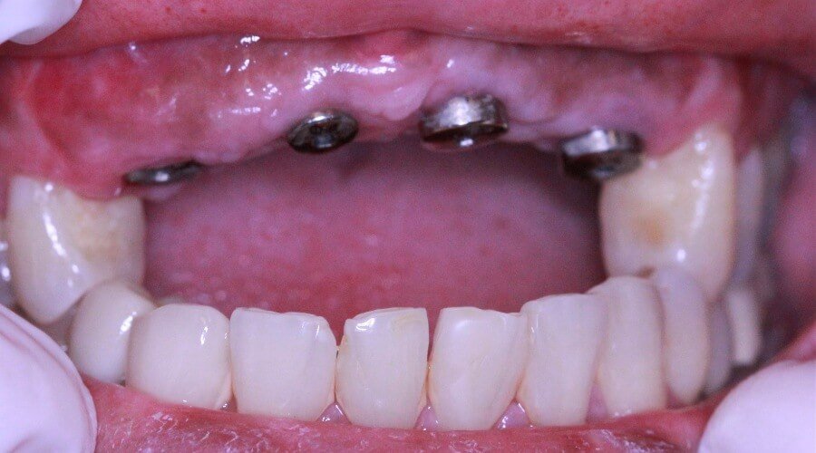 Real Smile Transformation Image